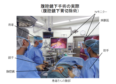 腹腔鏡手術
