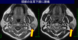 中放.25