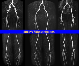 中放.35