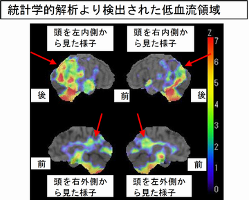 中放.46