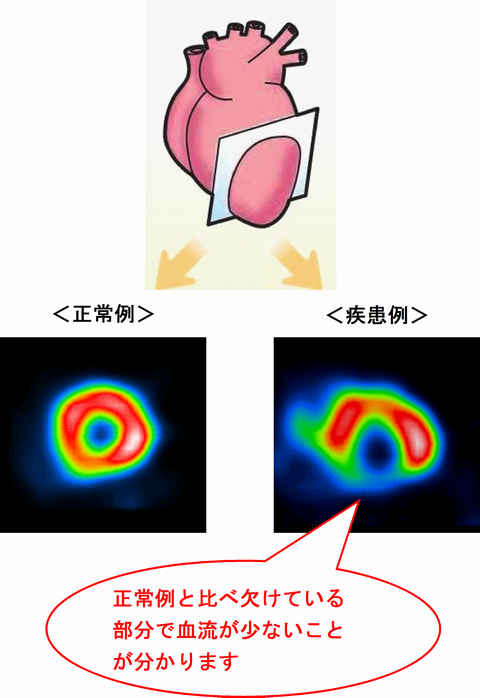 中放.47