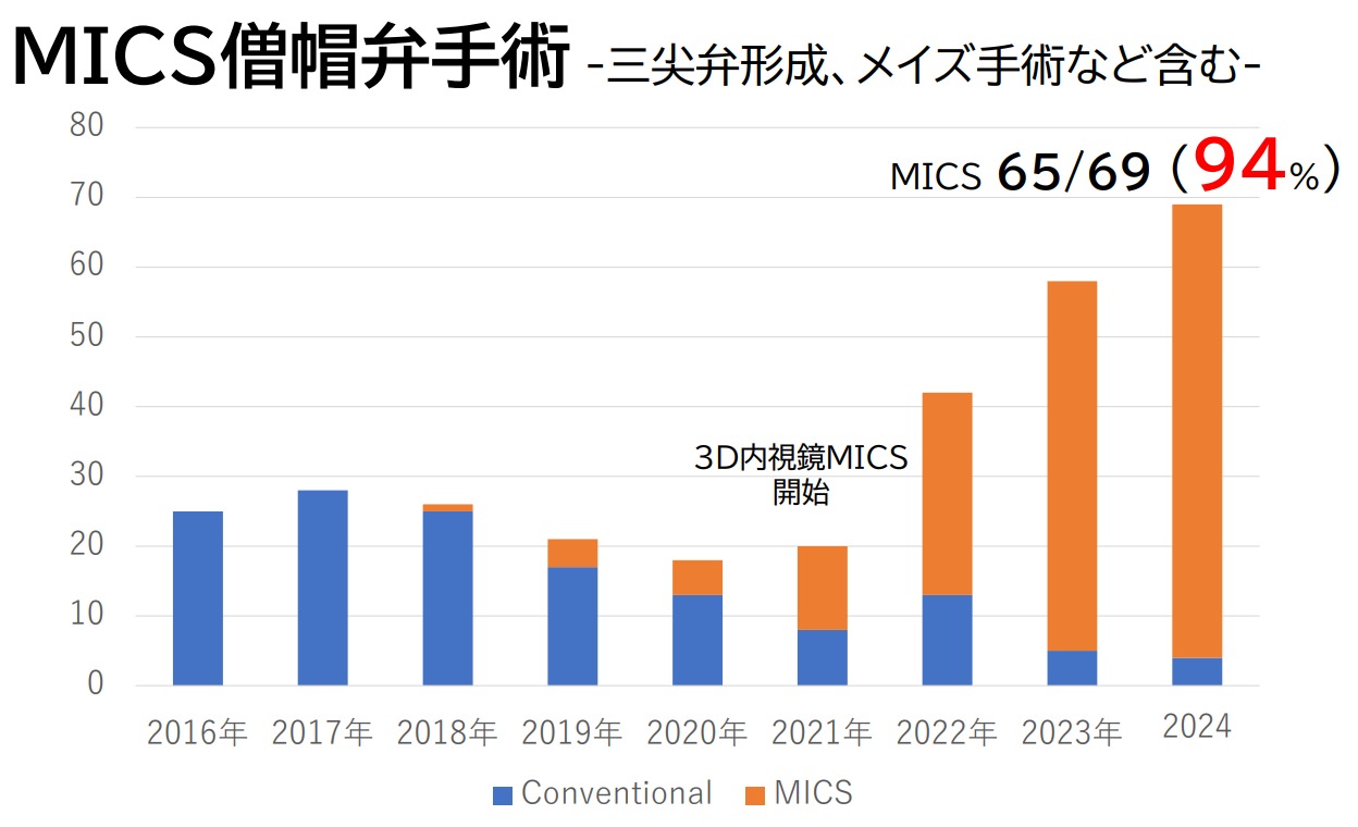 MICS 僧帽弁手術件数　-三尖弁形成、メイズ手術を含む 