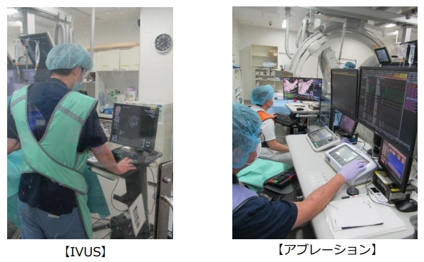 IVUS、アブレーション 